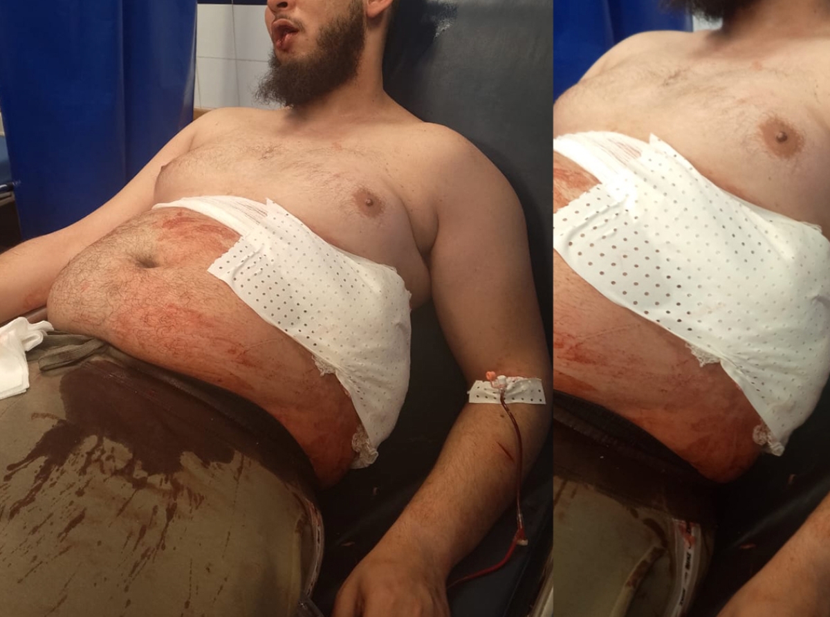 محاولة قتل في حي المدرسة تنتهي بإلقاء القبض على الجاني في وقت قياسي